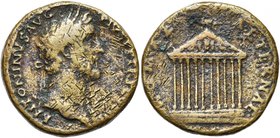 ANTONIN le Pieux (138-161), AE sesterce, 140-143, Rome. D/ ANTONINVS AVG PIVS PP TR P COS III T. l. à d. R/ ROMAE AETERNAE/SC Temple décastyle sur tro...